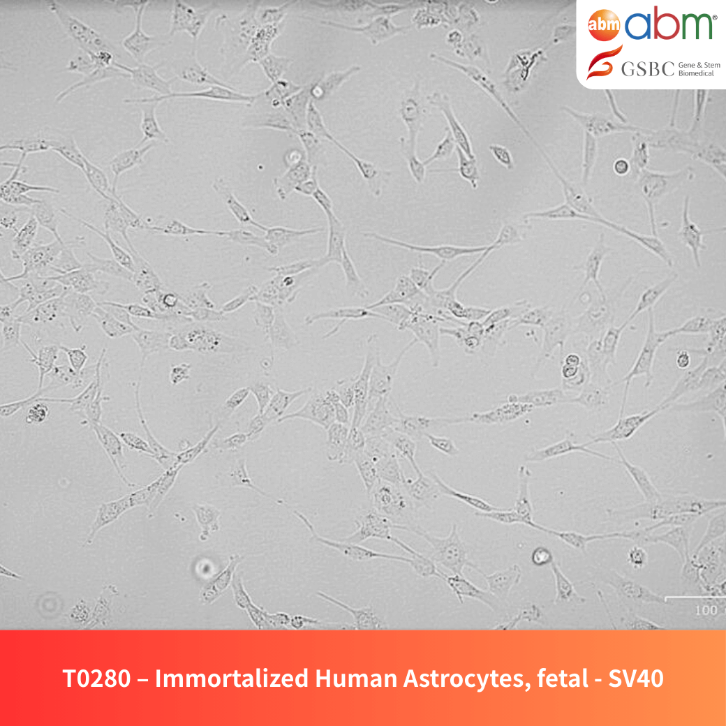 Immortalized Human Astrocytes (Fetal, SV40)