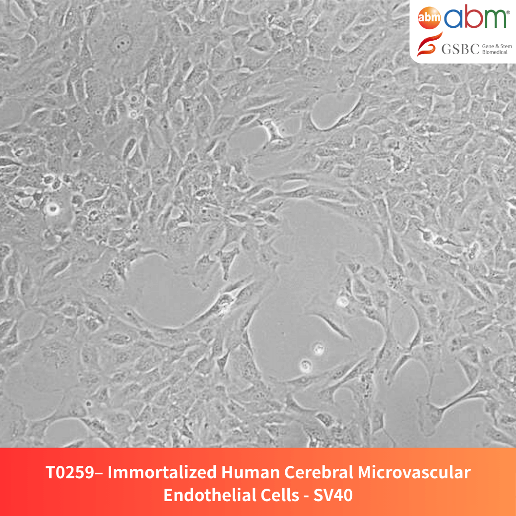 Immortalized Human Cerebral Microvascular Endothelial Cells - SV40