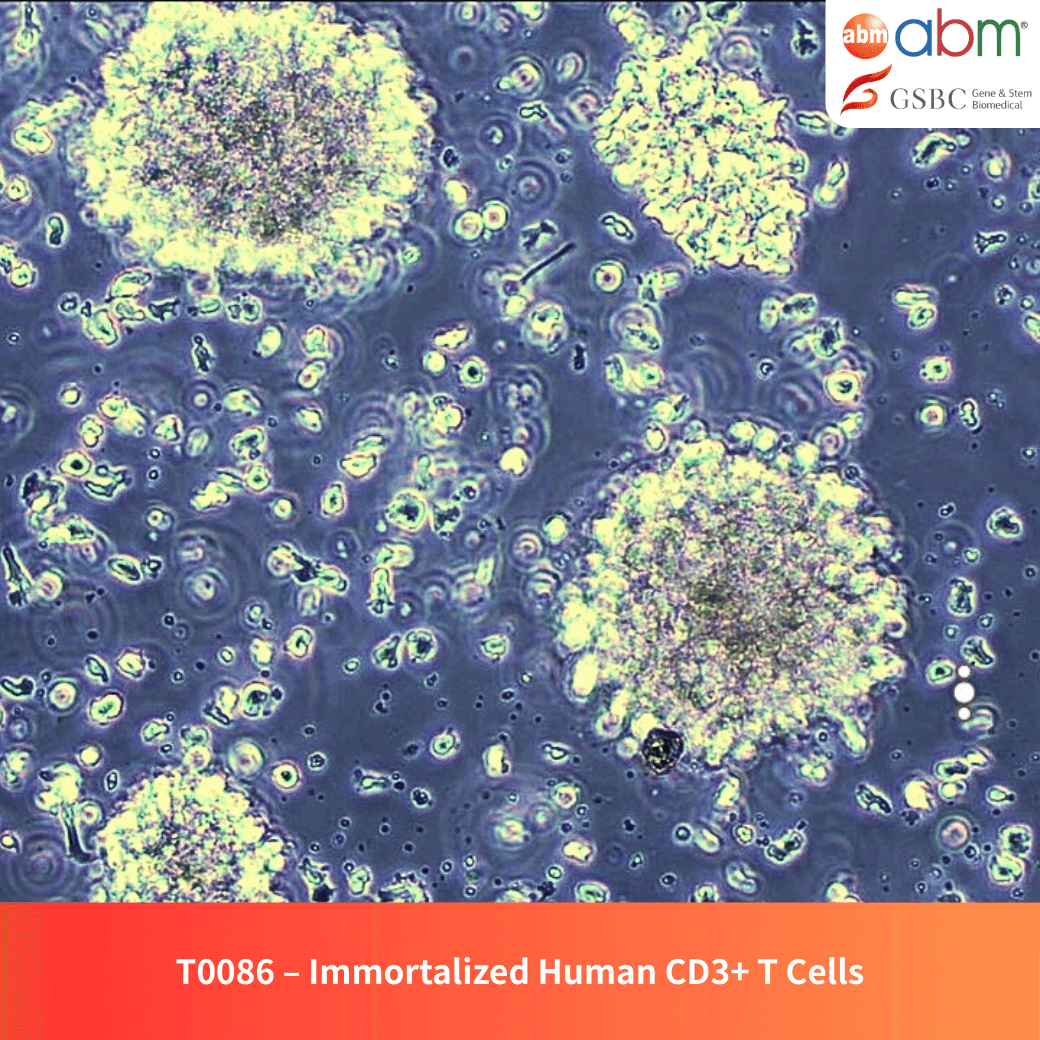 Immortalized Human T Cells
