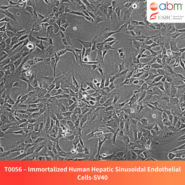 Immortalized Human Hepatic Sinusoidal Endothelial Cells - SV40