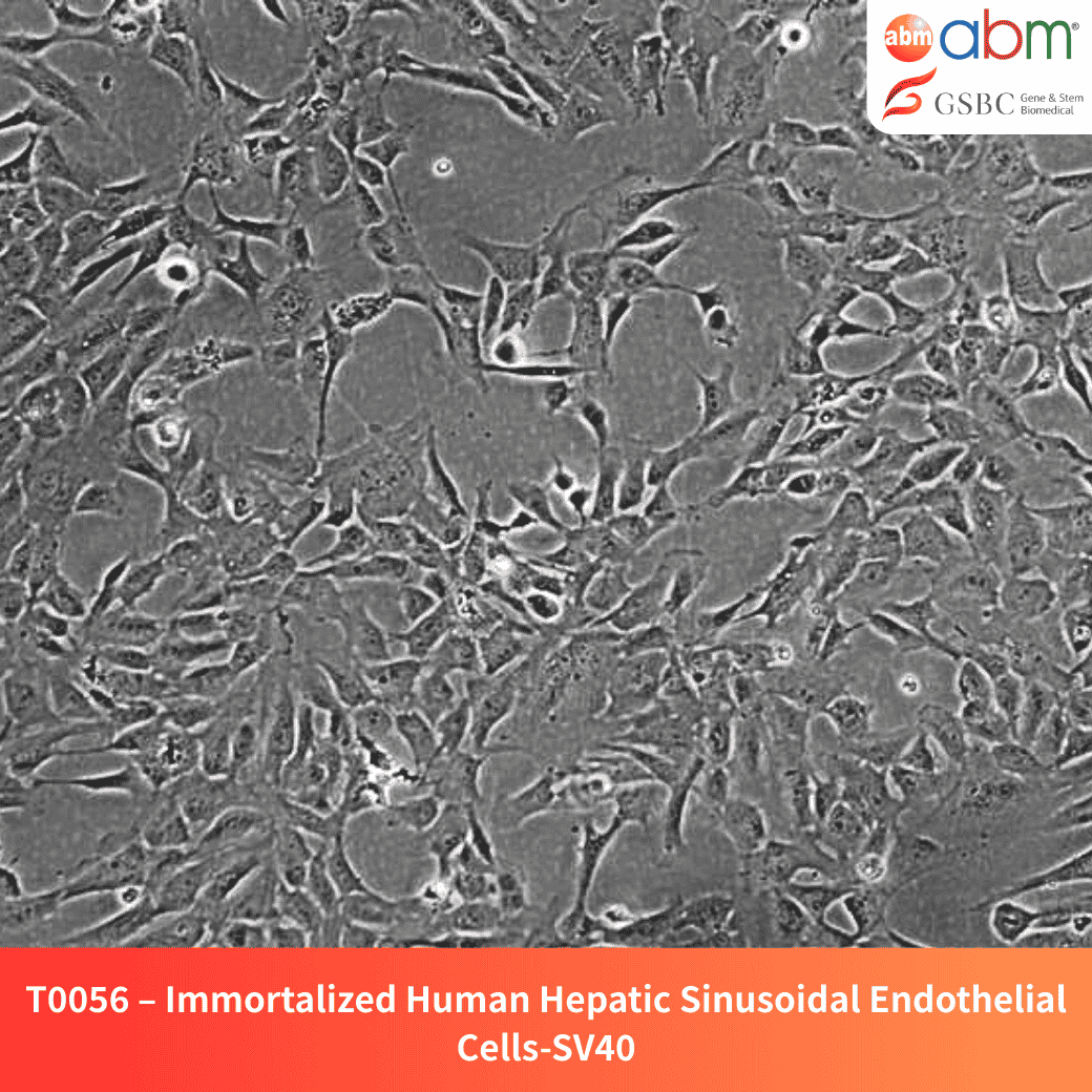 Immortalized Human Hepatic Sinusoidal Endothelial Cells - SV40