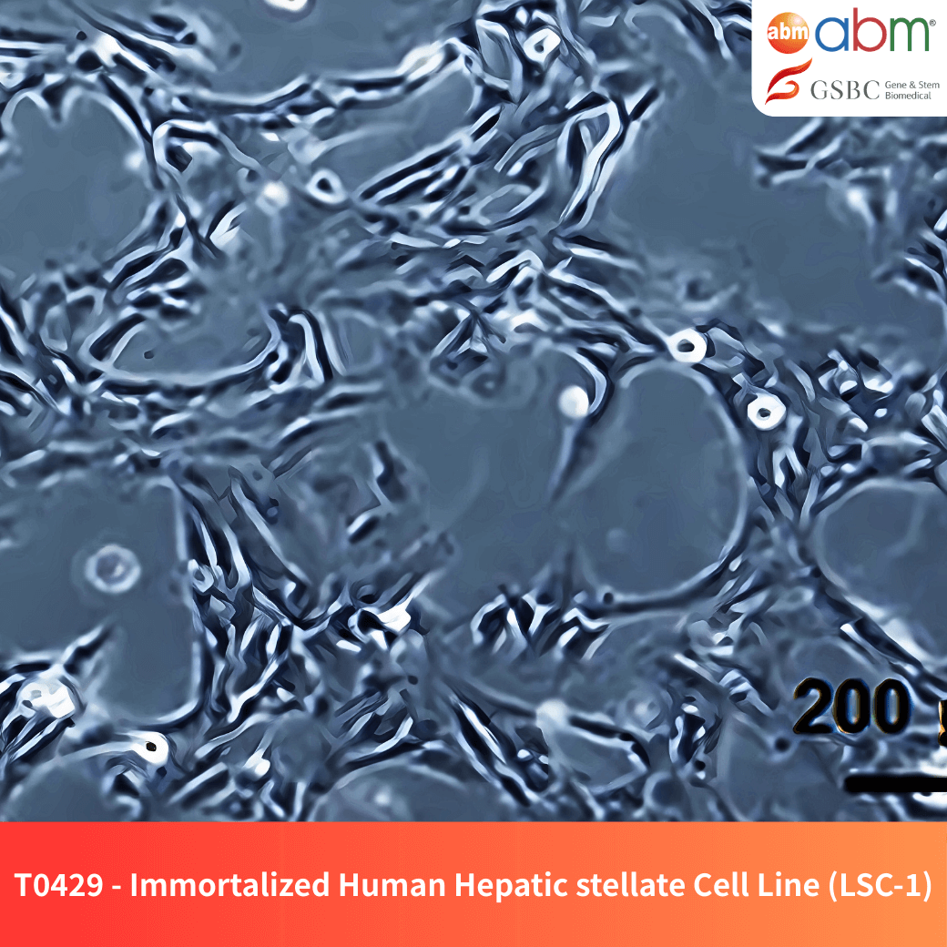 Immortalized Human Hepatic Stellate Cell Line (LSC-1)