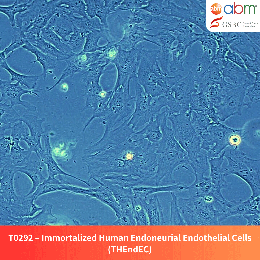 Immortalized Human Endoneurial Endothelial Cells (THEndEC)