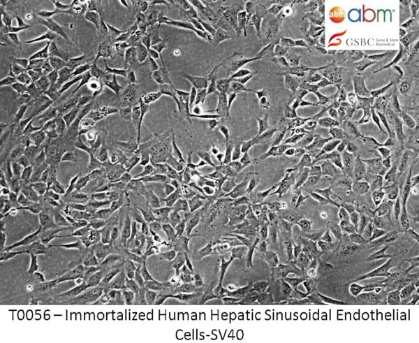 Immortalized Human Hepatic Sinusoidal Endothelial Cells - SV40
