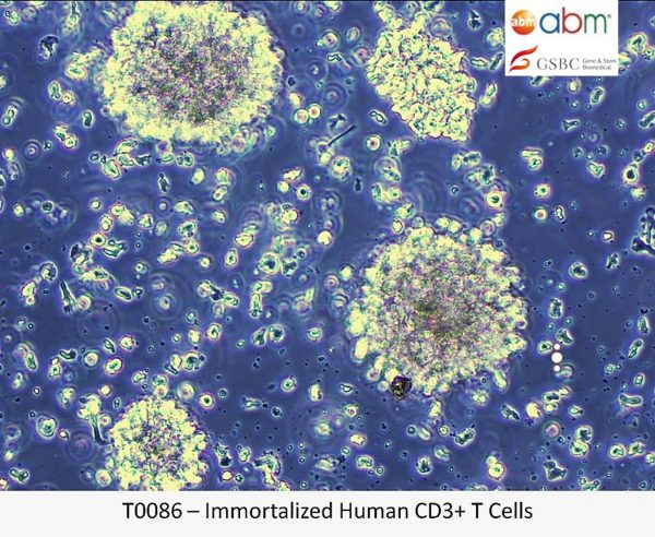 Immortalized Human T Cells