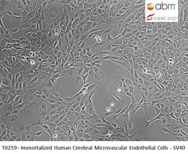 Immortalized Human Cerebral Microvascular Endothelial Cells - SV40