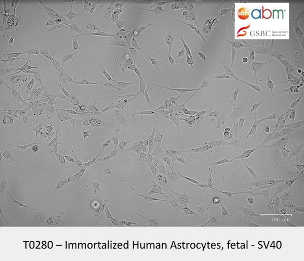 Immortalized Human Astrocytes (Fetal, SV40)