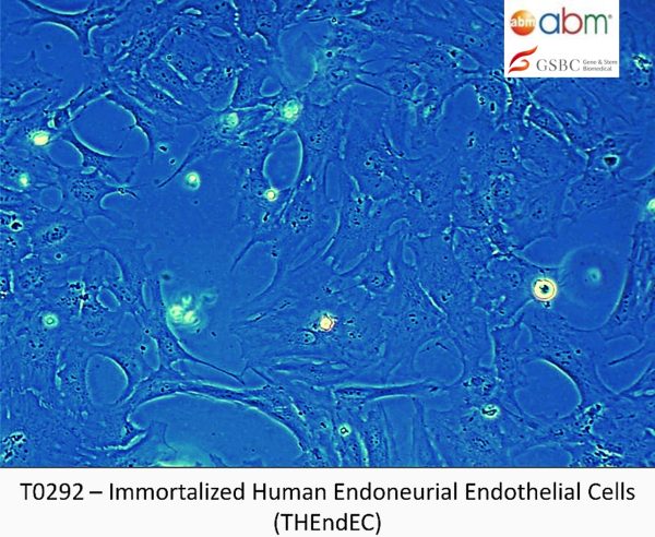 Immortalized Human Endoneurial Endothelial Cells (THEndEC)