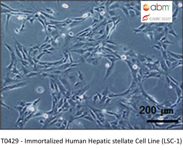 Immortalized Human Hepatic Stellate Cell Line (LSC-1)