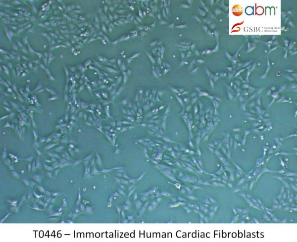 Immortalized Human Cardiac Fibroblasts