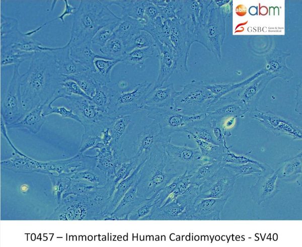 Immortalized Human Cardiomyocytes - SV40T