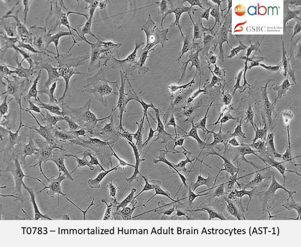 Immortalized Human Adult Brain Astrocytes (AST-1)